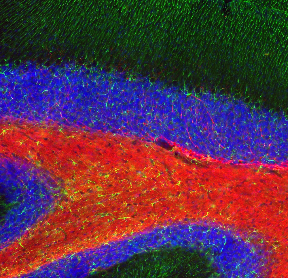 Anti Myelin Basic Protein Arg Arigobio